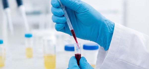 Biotech- und Life-Science-Boom: Evotec, BioNxt Solutions und Merck &ndash; wo lohnt sich ein Investment?